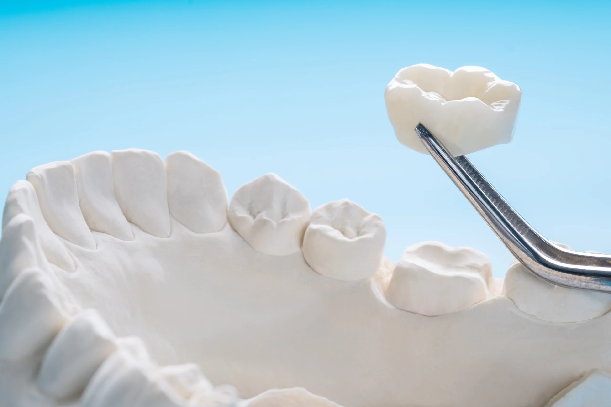 dental crowns near you