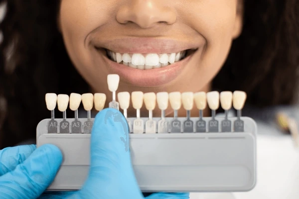 dental veneers in little italy, on