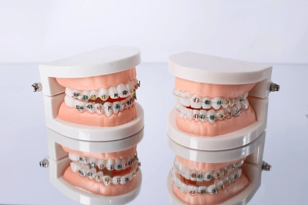 orthodontics in little italy, on