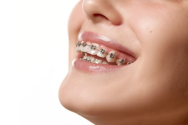 orthodontics near you