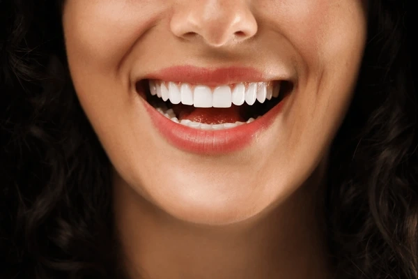teeth whitening near you