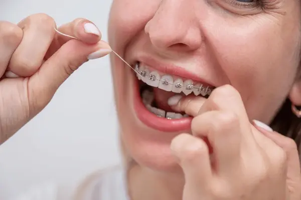 braces near you