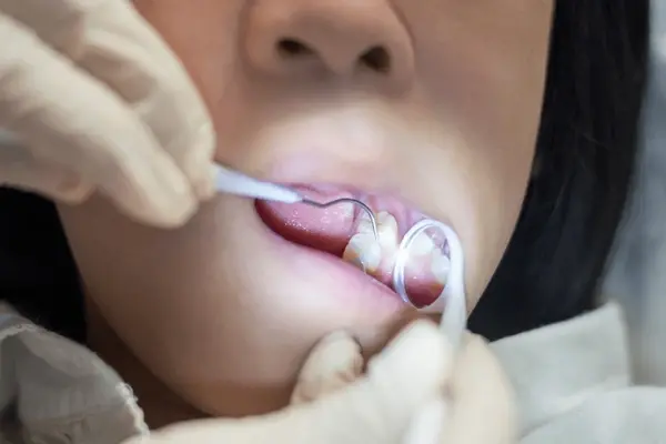 childrens dental sealants in little italy, on