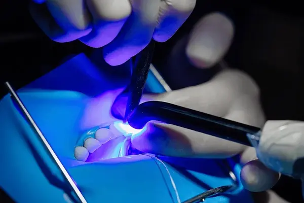 cosmetic bonding near you