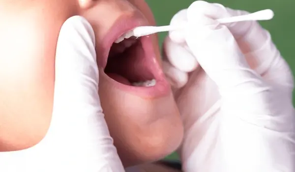fluoride treatment near you