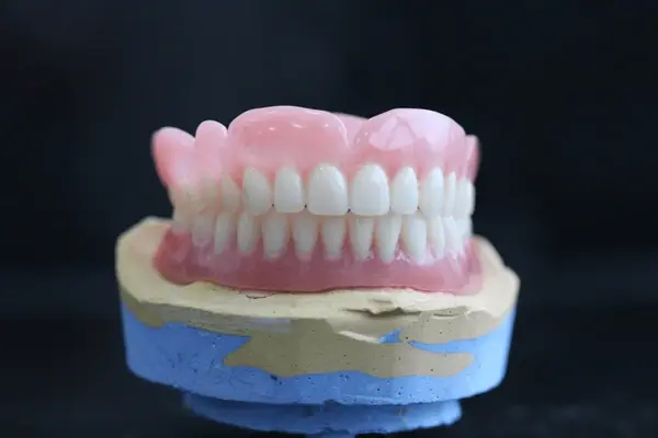 full mouth dental implants near you