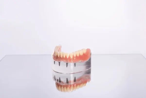 implant supported dentures in little italy, on