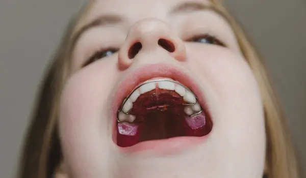 interceptive pediatric orthodontics in little italy, on