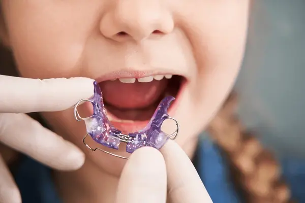 interceptive pediatric orthodontics near you