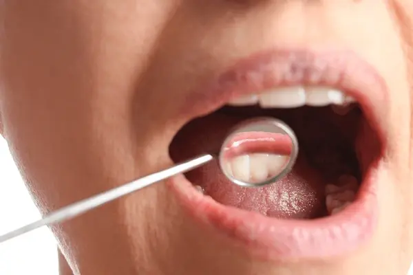 oral cancer screening near you