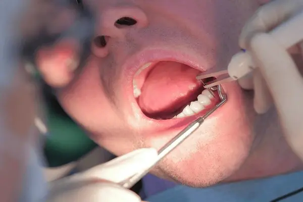 periodontal probing assessments in little italy, on