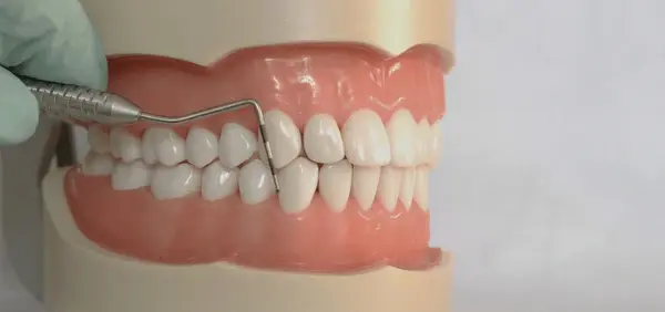 periodontal probing assessments near you