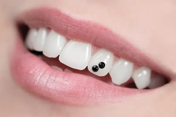 tooth jewelry in little italy, on