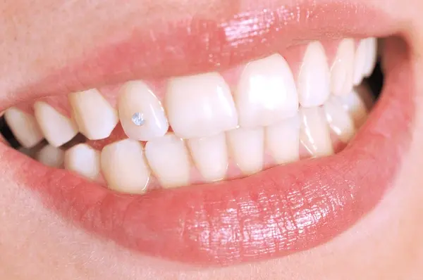 tooth jewelry near you